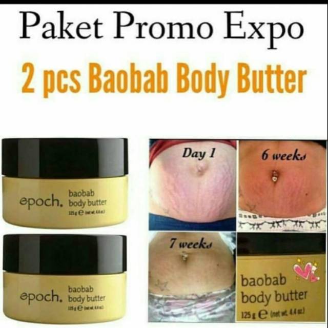 Epoch Paket Baobab Body Butter Menghilangkan Stretchmarks Stretch mark juga Selulit