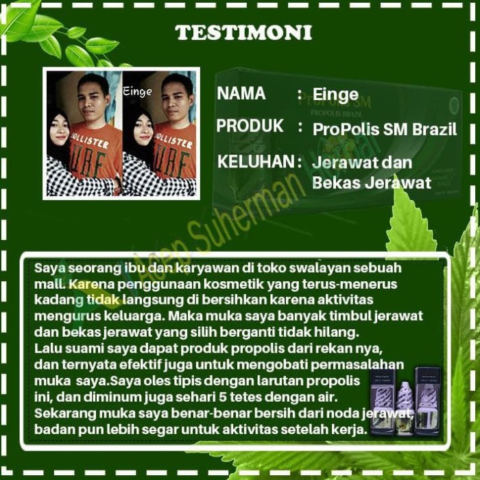 Obat Penghilang Bekas Luka Koreng, Salep Penghilang Bekas Luka, Salep Penghilang Bekas Jerawat, Salep Bekas Jerawat, Obat Penghilang Bekas Luka Koreng Hitam, Obat Bekas Luka Koreng, Penghilang Flek Hitam