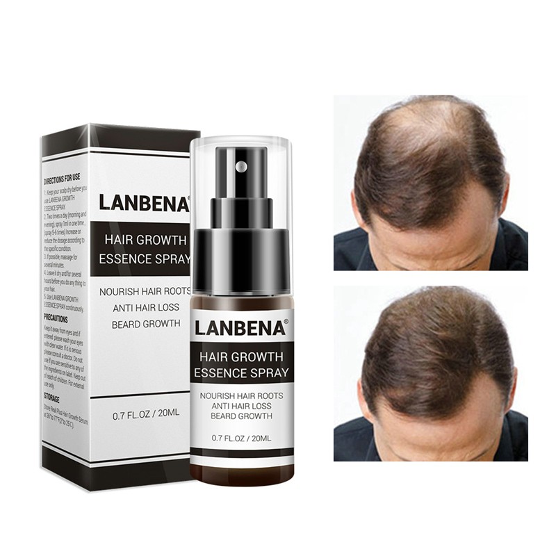 Lanbena Fast Powerful Hair Growth Products Hair Spray Essence Anti