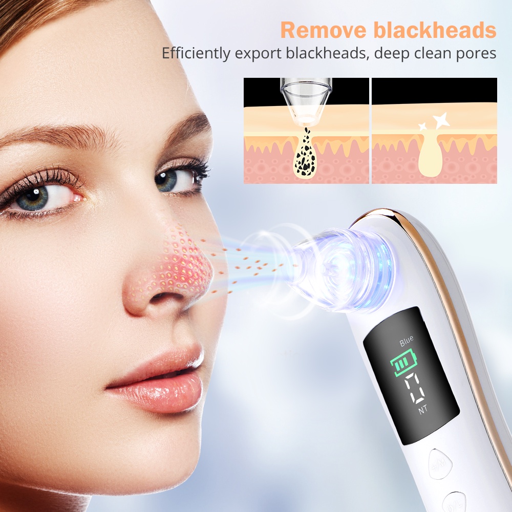 Alat Penyedot Komedo/Alat Pembersih Komedo/Vakum Penyedot Komedo/blackhead Remover