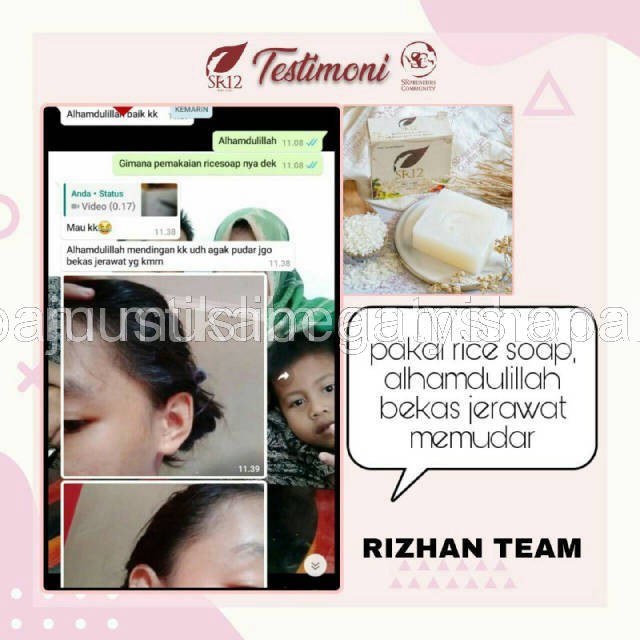 SABUN BERAS HERBAL SR12 TERLARIS..!! RICE SOAP / SABUN JERAWAT BPOM / KULIT BERMINYAK &amp; SENSITIF