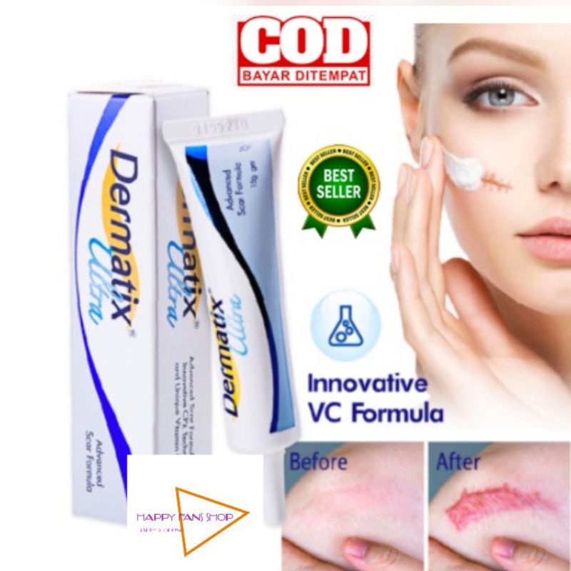 Dermatix Ultra Advanced Scar Formula Gel Cream Salep Penghilang Bekas Luka / Keloid ANTI SCAR Cream Krim Digigit Serangga Nyamuk Luka Bakar Stretchmark Stretch Mark 15gr Operasi Oprasi Iris Tergores Jerawat Gatal Hitam Ampuh