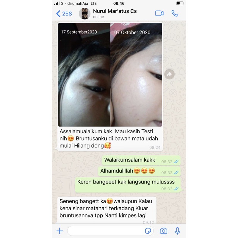 Paket Acne Dosting Colista skin Care-1