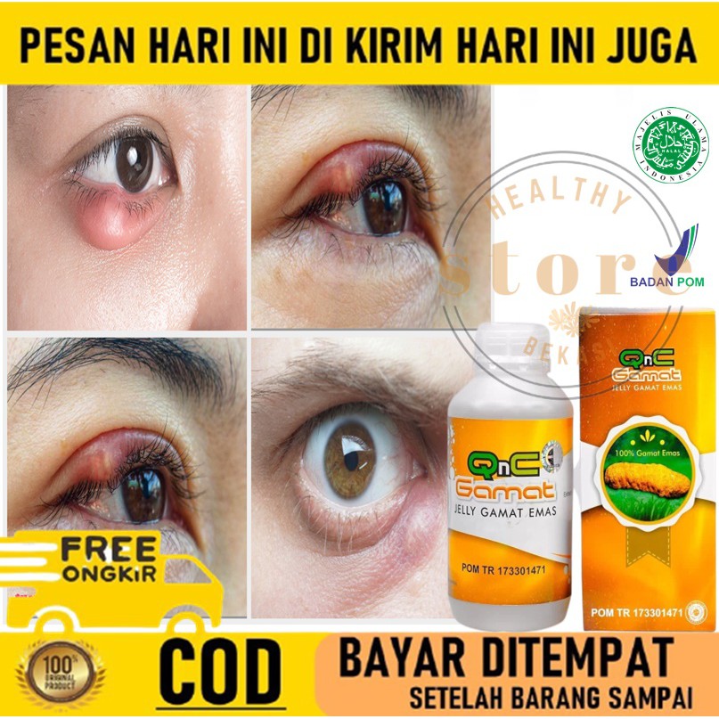 Jual Obat Oles Penghilang Benjolan Di Mata Obat Bintitan Obat