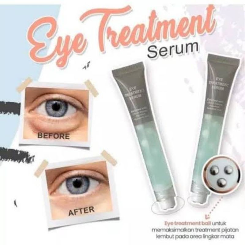 Ms Glow Eye Treatment Serum | Cream Penghilang Mata Panda