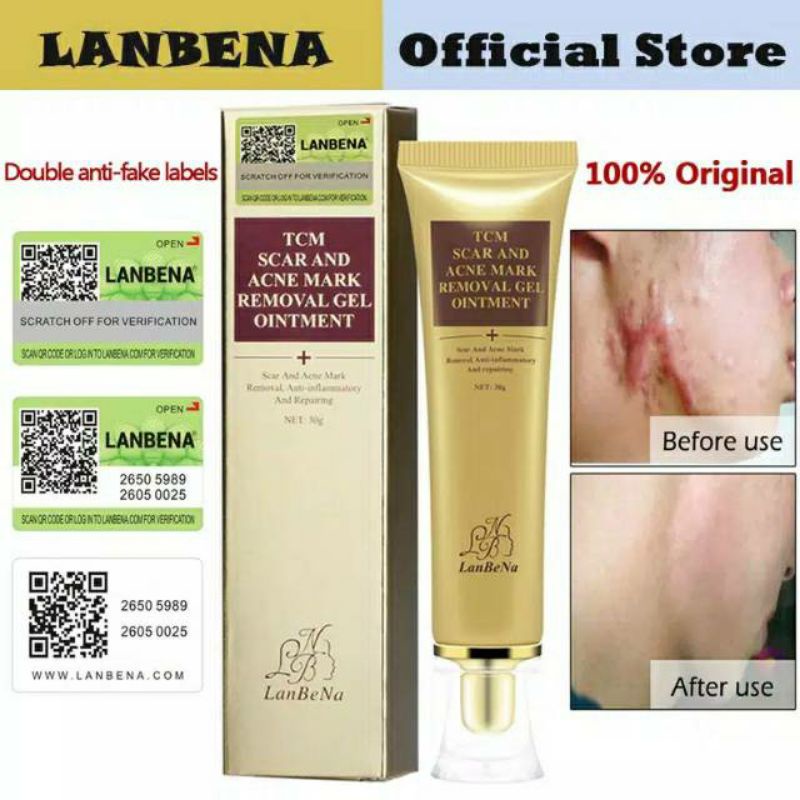 LANBENA Original Acne Removal Cream Perbaikan Kulit