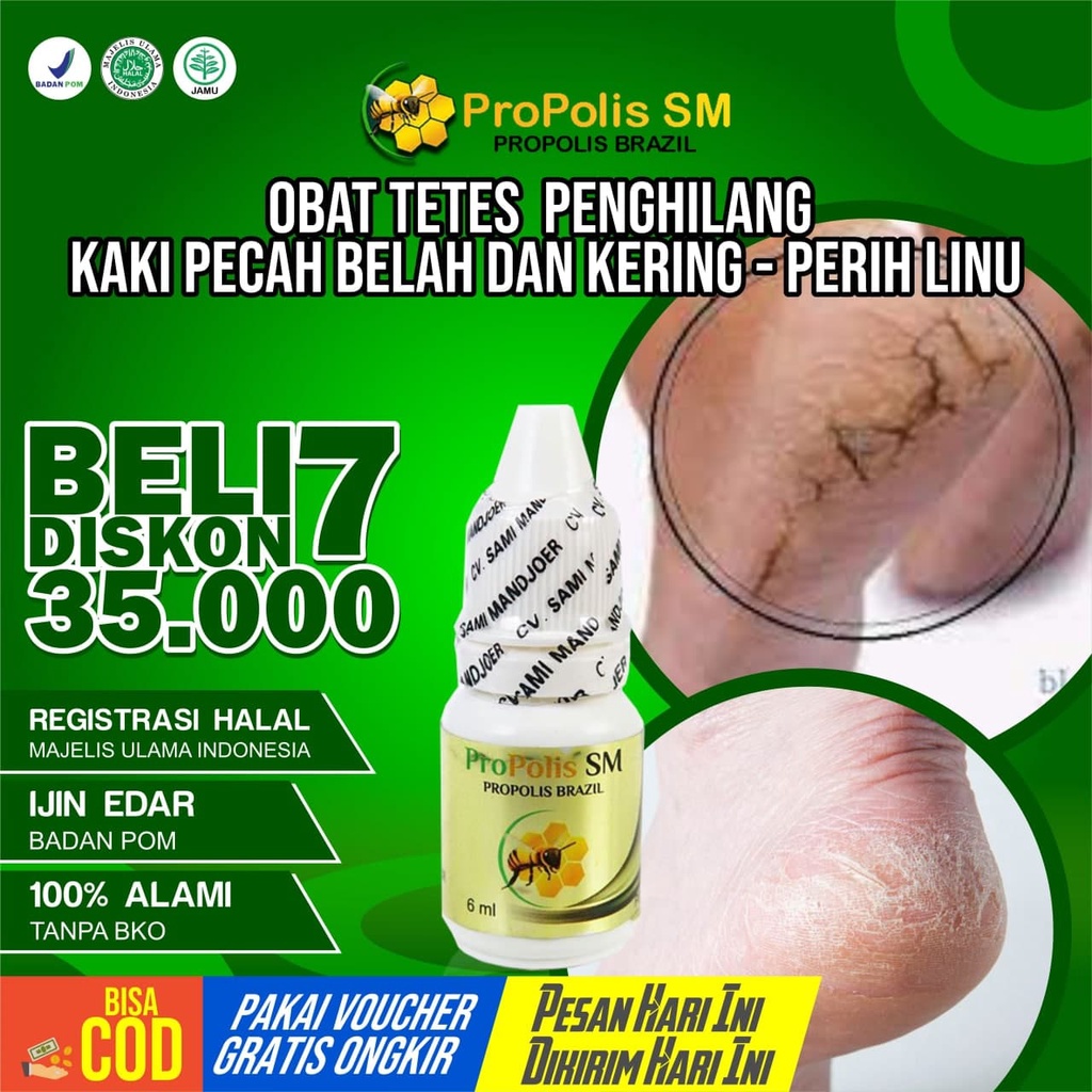 Obat Kaki Pecah Belah Dan Kering - Telapak Kaki Pecah Pecah - Perih Linu - Obat Tetes PROPOLIS SM 10