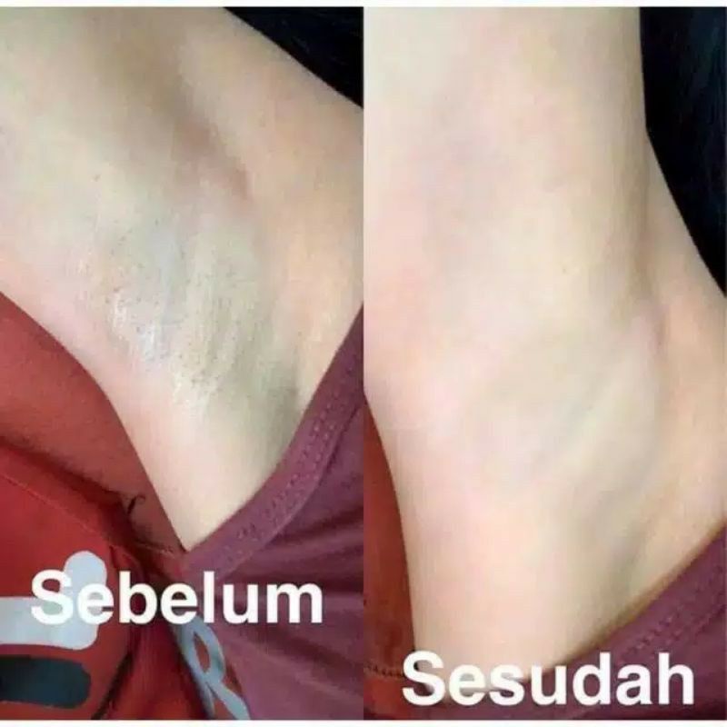 Cream Pencerah Lipatan - pemutih ketiak / selangkangan - krim slengky [ CREAM LIPATAN MURAH ]