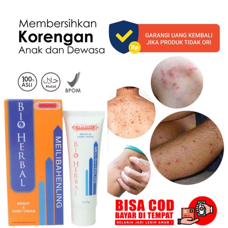 [ORIGINAL] PENGHILANG BEKAS LUKA LAMA FLEK HITAM MEMBANDEL CREAM MEILIBAHENLING PENGHILANG LUKA KORENG BOPENG KELOID OBAT JERAWAT FLEK ALAMI AMAN MEILIBAHENLING ORIGINAL BPOM