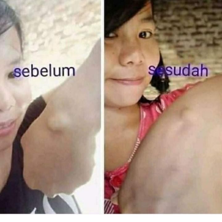 Ready stock ot Penghilang Benjolan Ampuh Chitosan Tiens YB Bayar Di Tempat￣