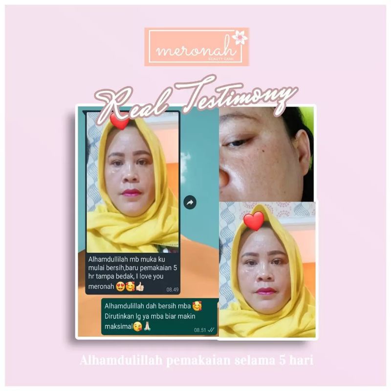 PAKET WAJAH SERUM GLOWING DAN CREAM MERONAH