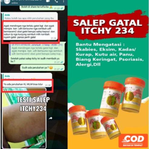 SALEP BELERANG SULFUR 2 - 4 ORIGINAL BPOM SALEP ZWAFEL GATAL KUDIS KADAS KURAP PANU GATAL DISELANGKANGAN HILANG