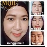 PAKET MQBeauty Brightening Series [free red jelly + cream jerawat] Skincare BPOM - MQ Beauty Krim Perawatan Wajah [ORIGINAL] 1 [ BAYAR DITEMPAT] [ASLI]-2