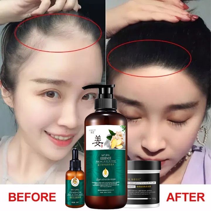 Shampo Jahe sampo 500ml penumbuh rambut cepat shampo penumbuh rambut Anti Ketombe Anti Gatal Anti Rambut perawatan rambut rontok penumbuh rambut botak paling ampuh dan cepat