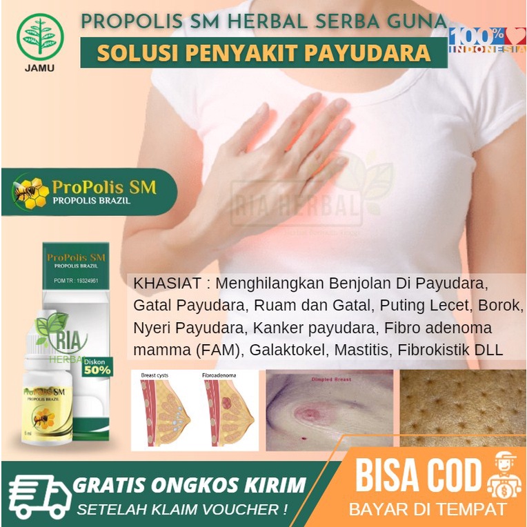 Obat Alami Penghilang Benjolan Di Payudara Ibu Menyusui, Penghancur Kista Payu Dara, Pengecil Fibroa