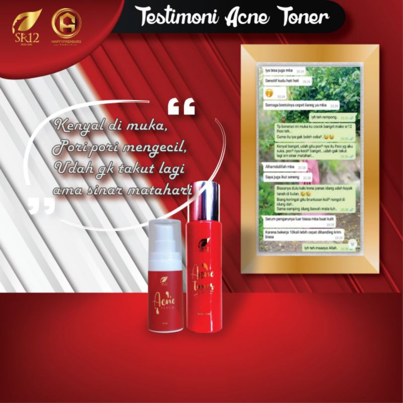 SR12 Acne Toner - Hydrating Toner Untuk Kulit Berminyak dan Berjerawat