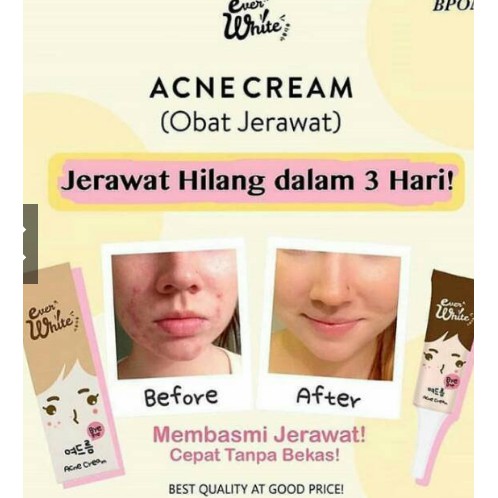 EVERWHITE ACNE CREAM 15ML