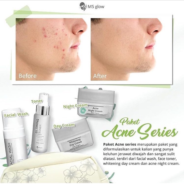 Ms Glow Paket Acne series/ Ms Glow Acne series / Paket Acne Ms Glow