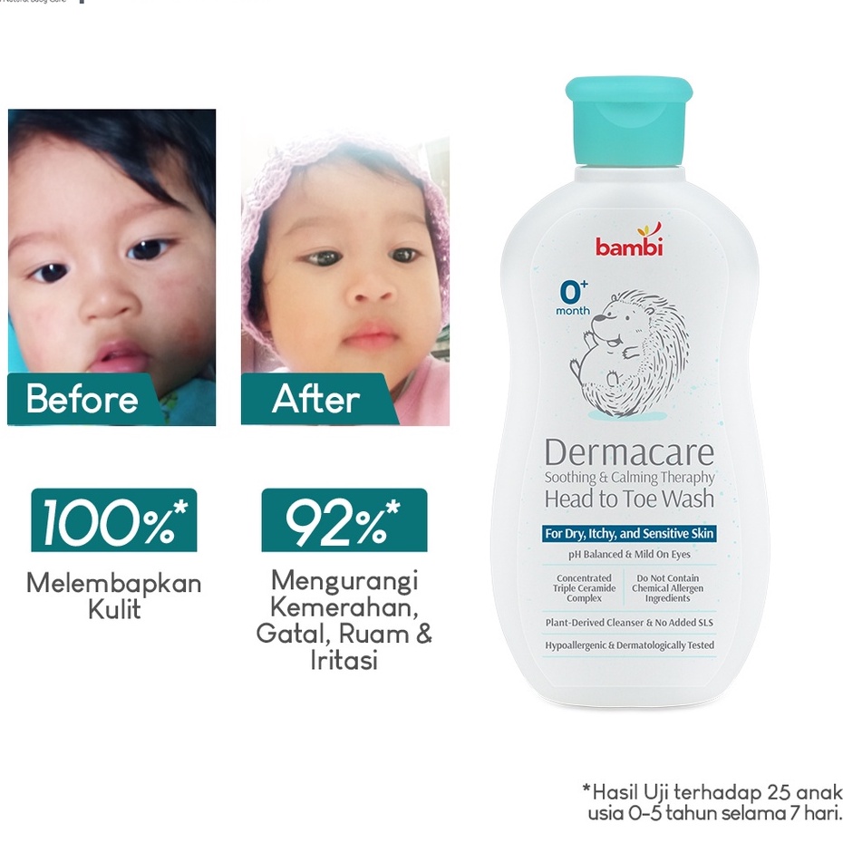 Bambi Baby Dermacare Daily Soothing &amp; Calming Theraphy Head To Toe Wash 200ml / Advanced Moisture Body Lotion 200ml /Powder Compact Dermacare 40gr