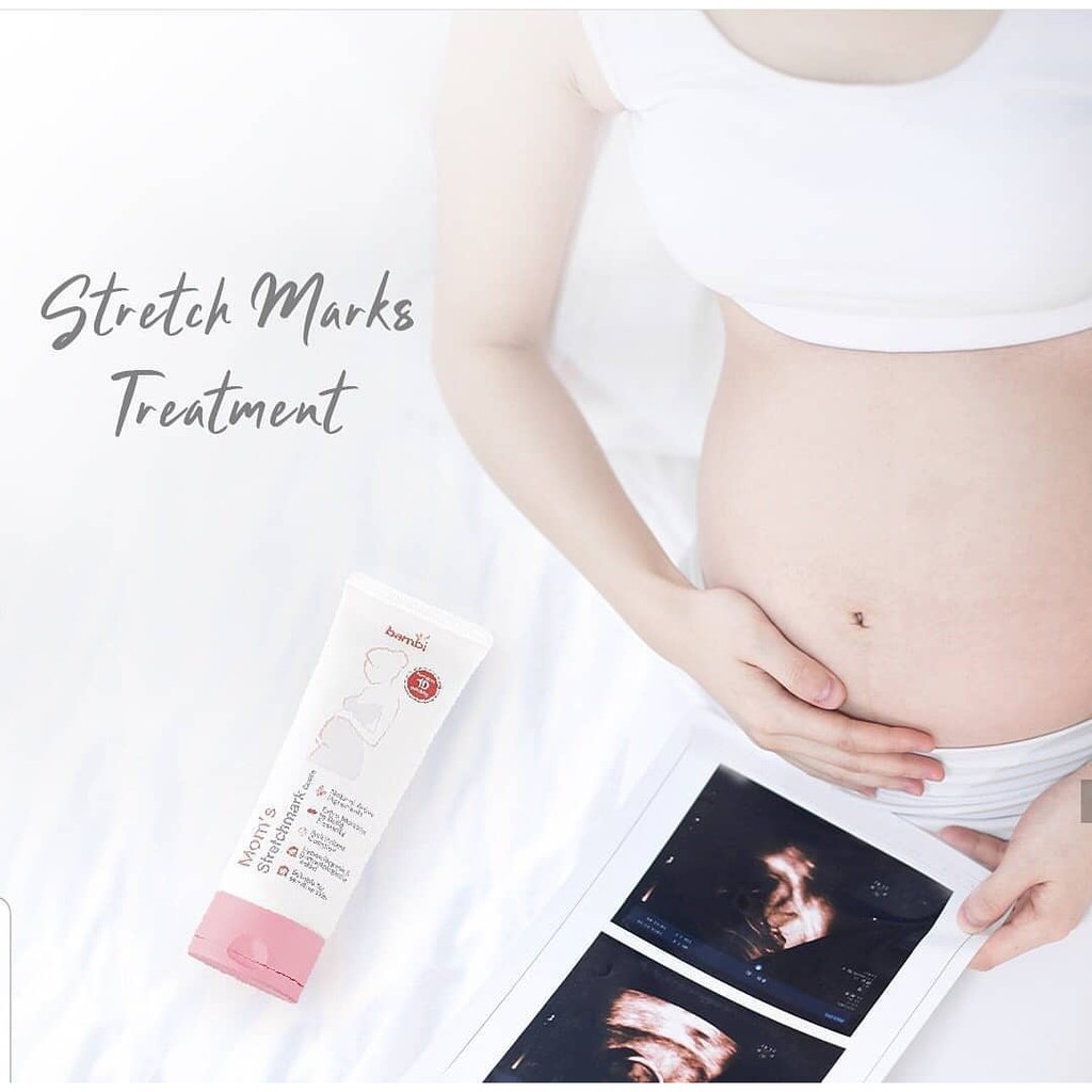 BAMBI BABY MOM'S STRETCHMARK CREAM 100ml - Krim Penghilang Kerutan Kulit