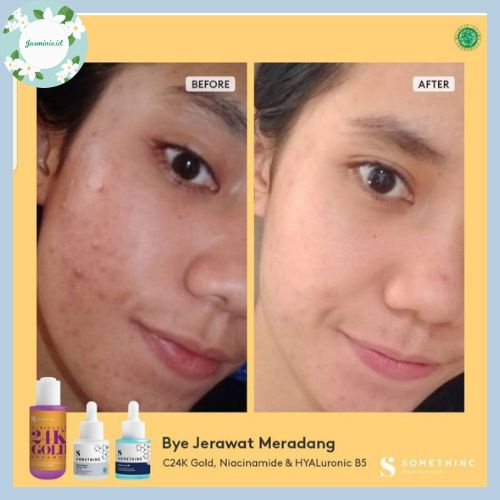 [SALE!] SOMETHINC 5% Niacinamide + Moisture Sabi Beet Serum - Mencerahkan Kulit