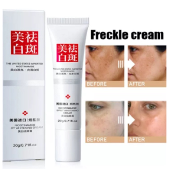 Whitening Cream Melasma Cream Pemutih Waja Melasma Flek Hitam