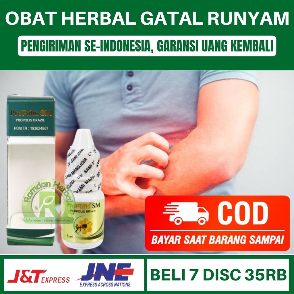 Obat Gatal Runyam Obat Gatal Runyem Gatal Selangkangan Gatal Daerah Kemaluan Propolis SM