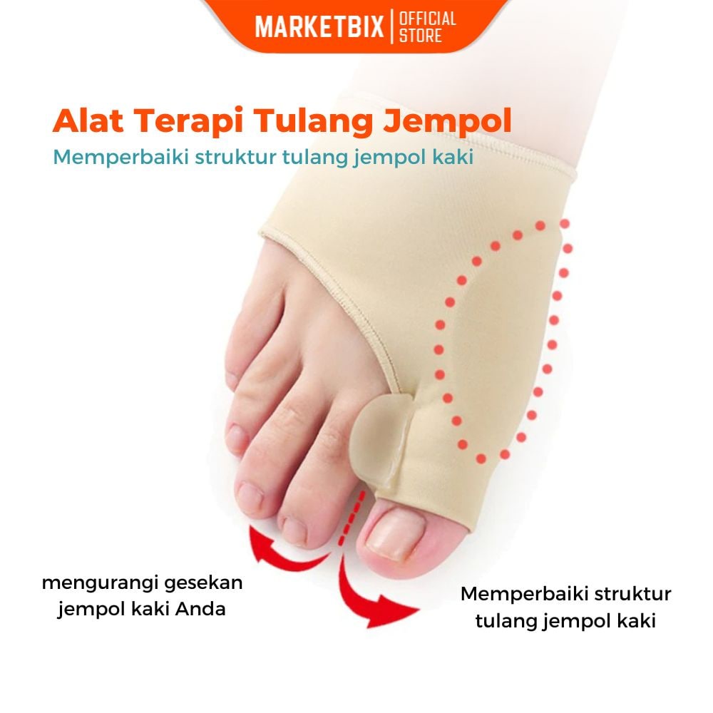 MARKETBIX Alat Terapi Sleeve Korektor Tulang Jempol Kaki Bunion Bengkok Hallux  Orthotics Sepasang