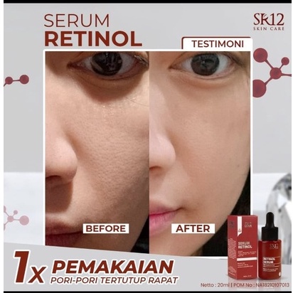 SERUM RETINOL SR12 / SERUM RETINOL / SERUM ANTI AGING / SERUM ANTI PENUAAN / ANTI WRINKLE / MENGATASI JERAWAT