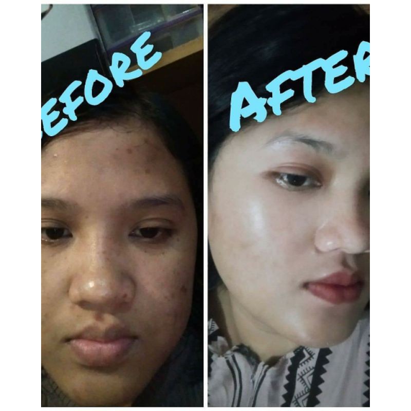 Brightening Soap Kedas Beauty | BPOM Best Seller-4