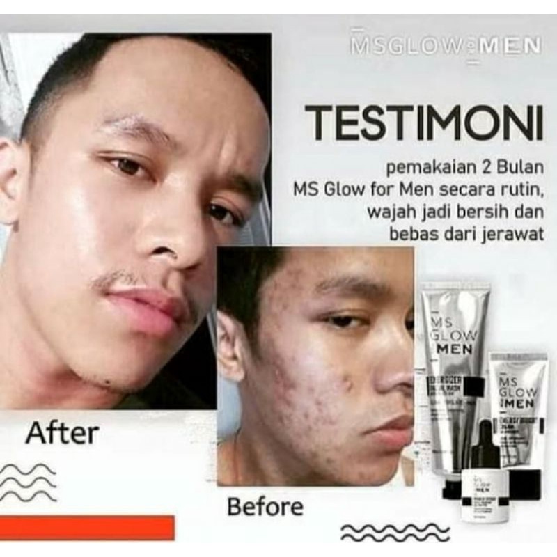 MS Glow Men Lengkap X Maskulin Mengatasi Kulit Berjerawat Mencerahkan Kulit Kusam - MS Glow Men