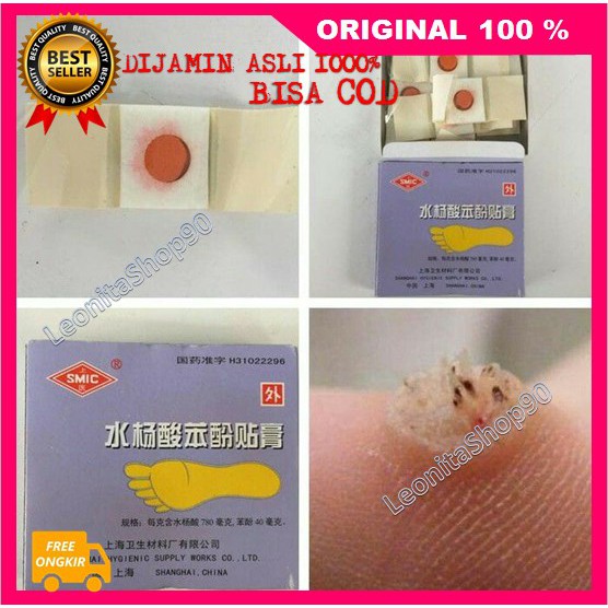 Plester Ji Yan Gao Obat Penghilang Kutil, Mata Ikan Dan Kapalan ORIGINAL
