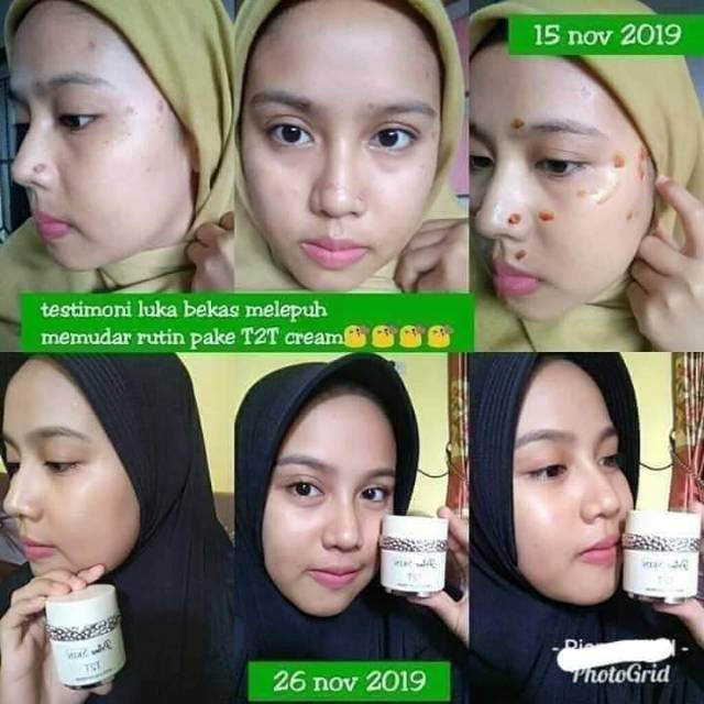 T2T ORIGINAL HWI 100%