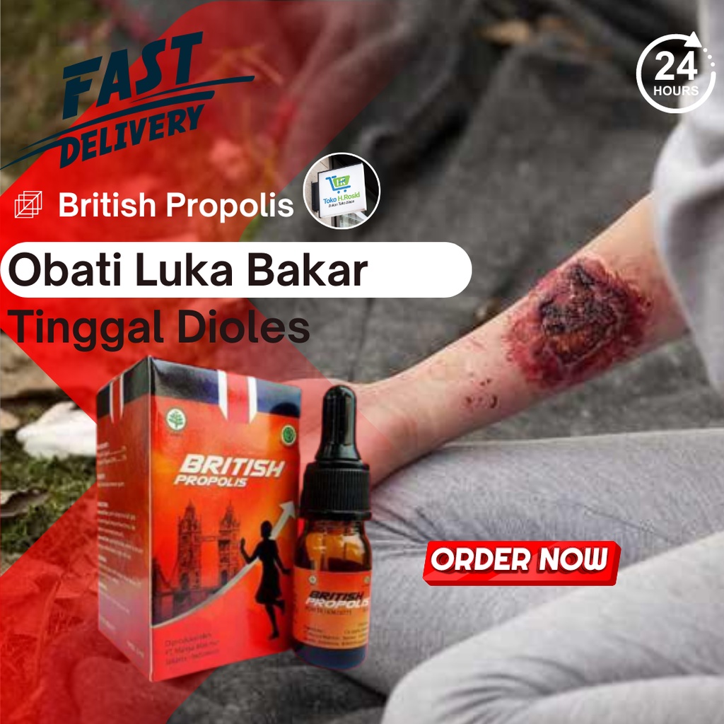 British Propolis Luka Bakar Kulit Luka Bakar Akibat Knalpot Luka Bakar Sengatan Listrik Infeksi Kuli