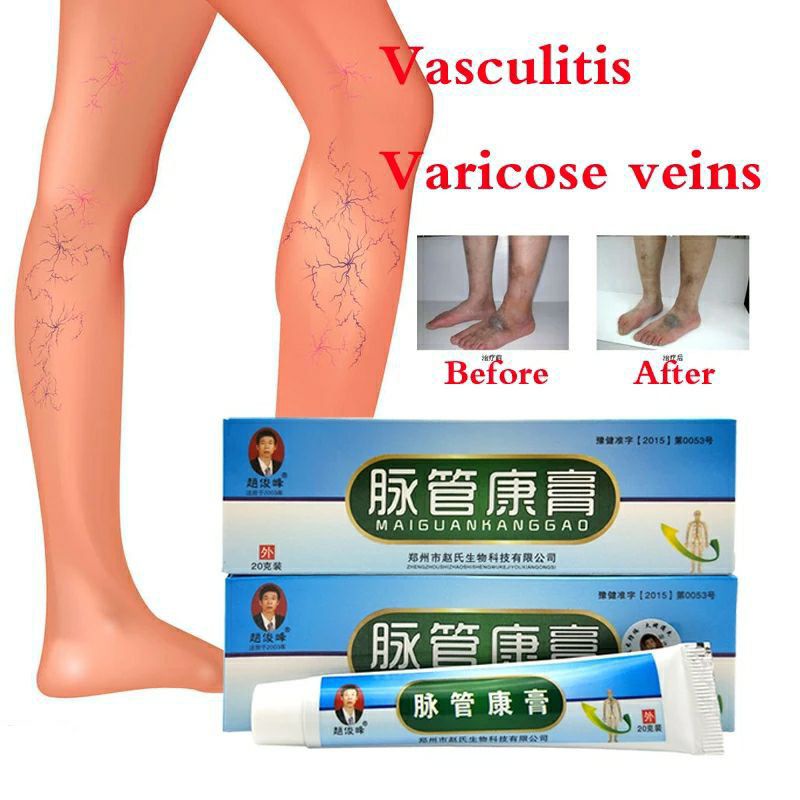 [ bisa COD] ~ SALEP PENGHILANG VARISES TRADITIONAL CHINA VARICOSE VEINS ORIGINAL