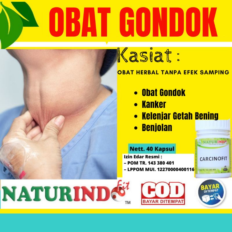 Obat Gondok paling ampuh, obat herbal gondok, herbal mengatasi  gondokan, herbal paling ampuh atasi gondok