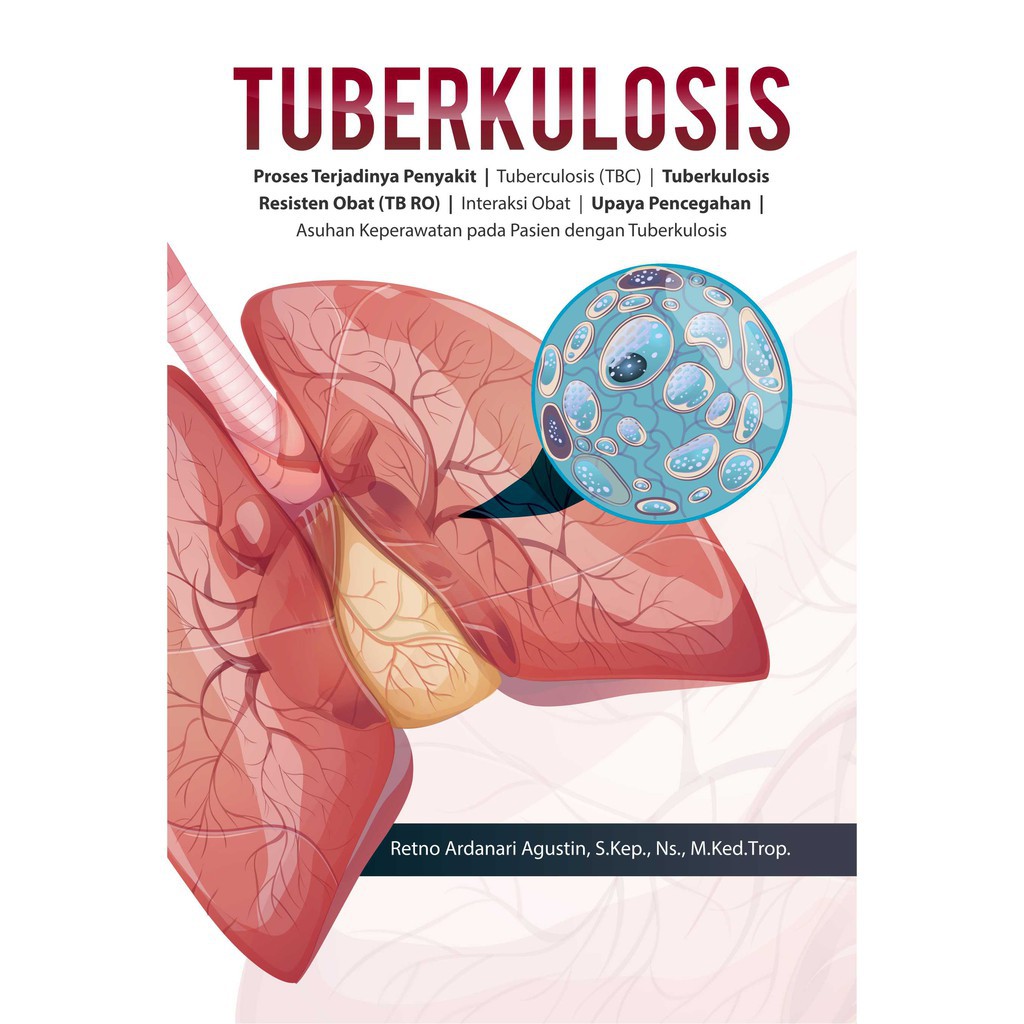 Buku Tuberkulosis