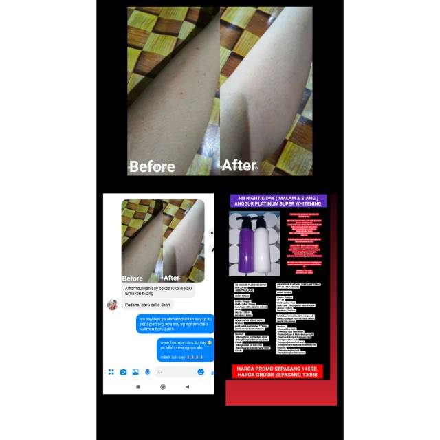 HB anggur platinum super whitening day/ night / handbody dosis tinggi / hb cepat putih dosis tinggi