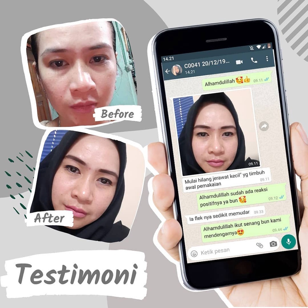 (GRATIS ONGKIR) Paket Premium VAS Skincare asli krim cream serum penghilang flek hitam membandel di wajah penghilang jerawat dan bekas jerawat pemutih glowing ampuh permanen bpom alami original