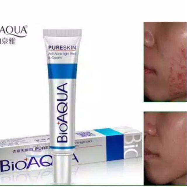 BIOAQUA PURE SKIN ACNE REJUVENATION & CREAM REMOVAL OF