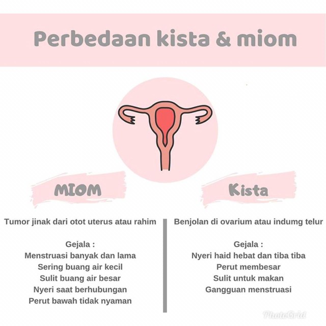 Promo - Kotak Tempat Perhiasan Dan Aksesoris Cincin Gelang Kalung / Jewelry Box Accesories