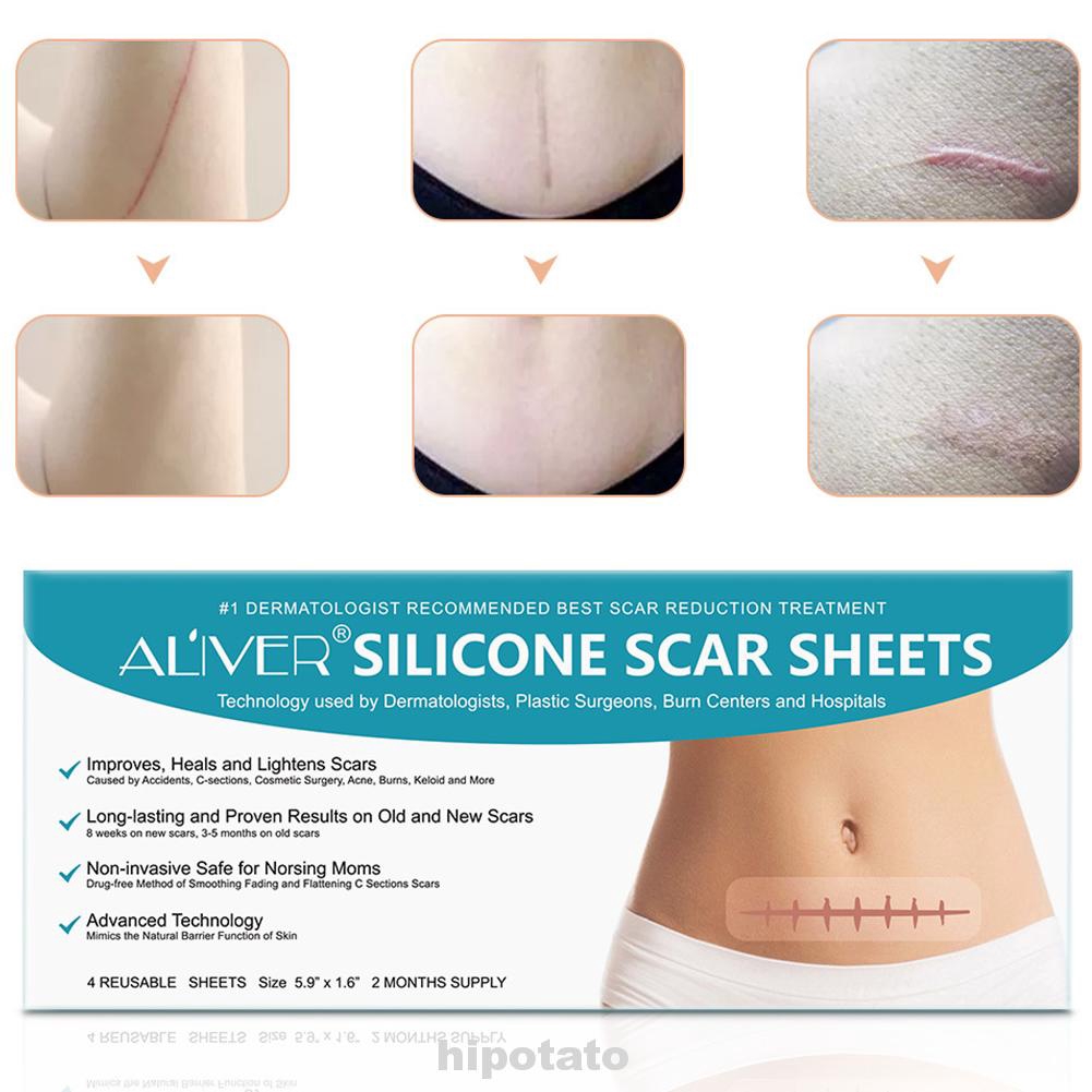 silicone sheets for old scars