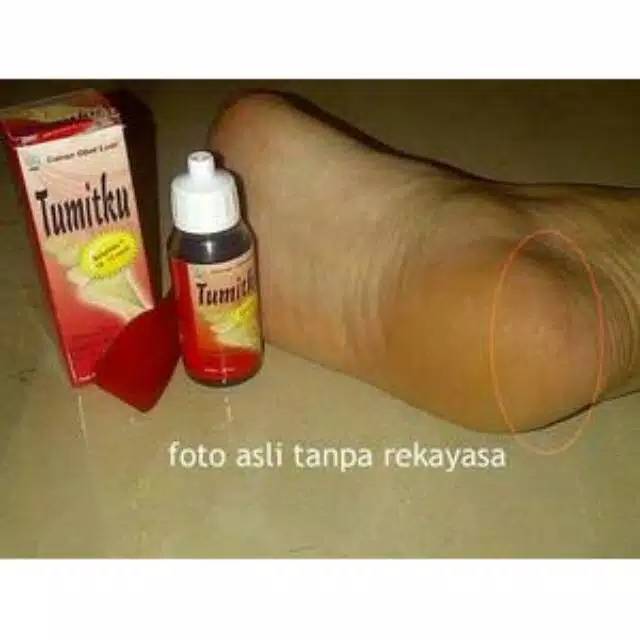 TUMITKU ( PENGHILANG KAKI PECAH - PECAH)