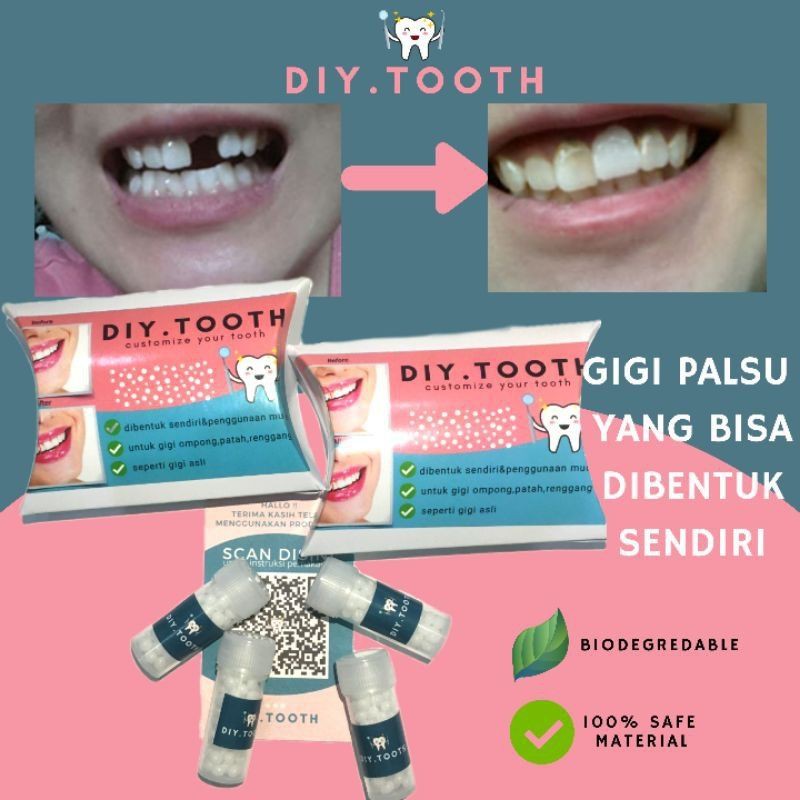 DIY TOOTH gigi palsu sementara / bisa dibentuk sendiri / veener sementara /  lem gigi / temptooth