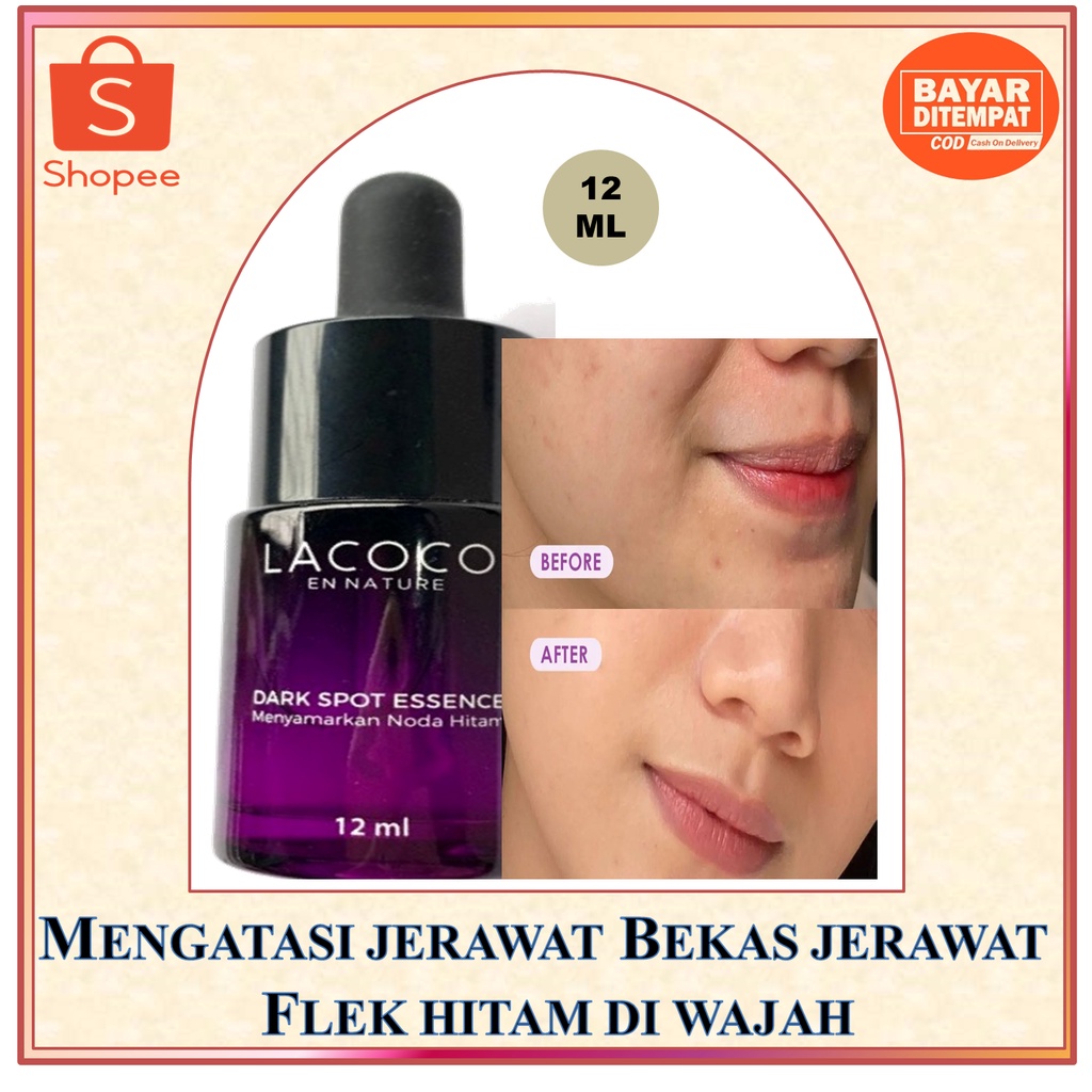 Lacoco dark spot serum penghilang flek penghilang bekas jerawat lacoco darkspot essence serum lacoco