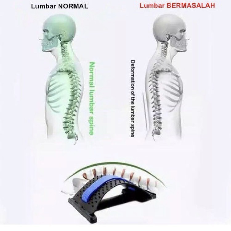 Powerback Thoracic Corrector Stretcher