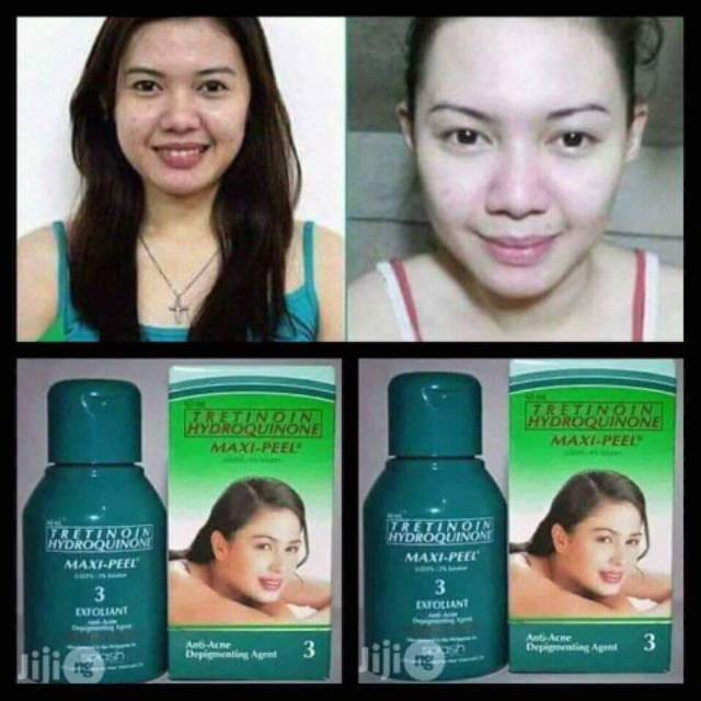 Maxi peel toner hijau Original