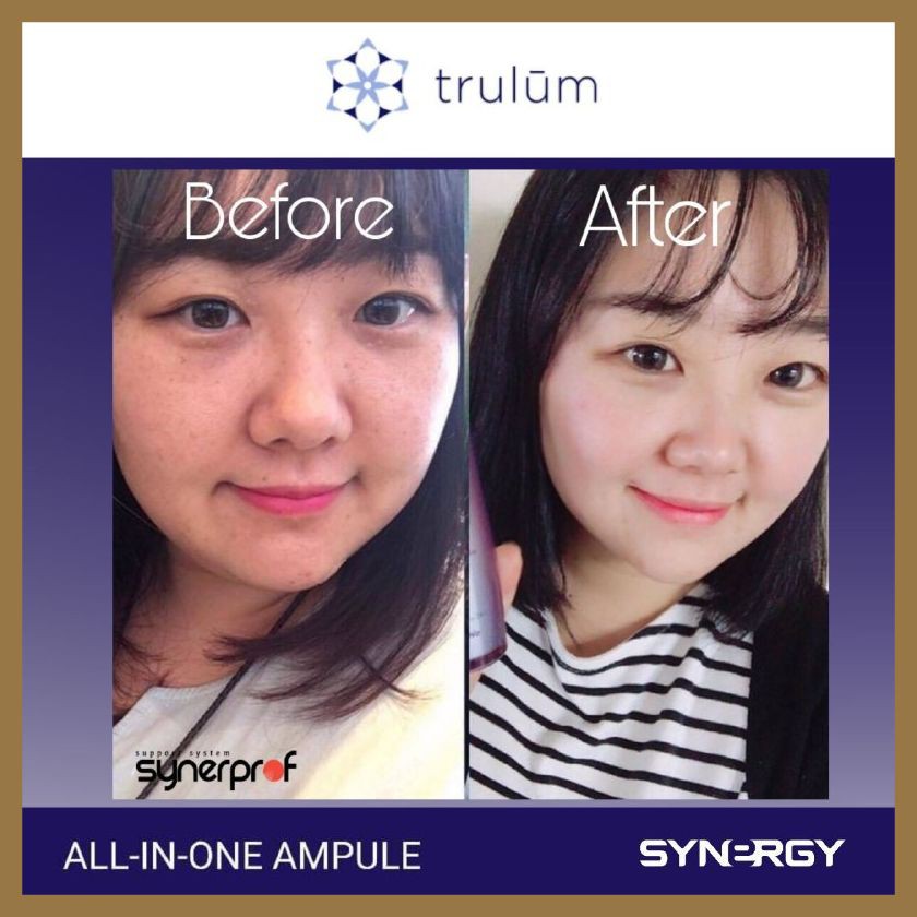 Trulum Skincare Pemutih Pencerah Wajah | Trulum Pengganti Krim Dokter