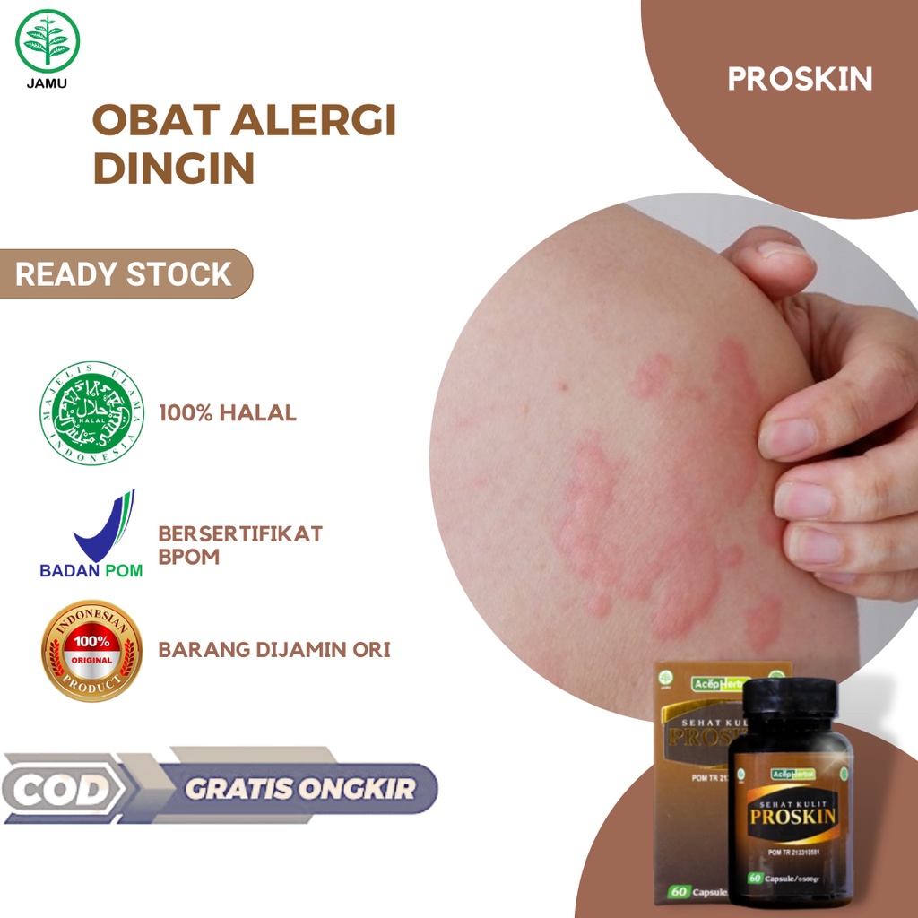 Obat Alergi Dingin, Obat Alergi Makanan, Obat Biduran, Kaligata, Obat Alergi Debu, Gatal Kulit Bento