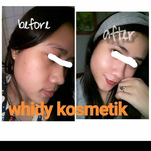 Testi cream HN